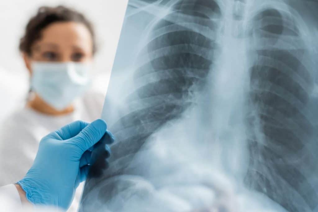 How to become a Radiologist in India